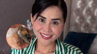 Gomita muestra escandalosa herida en el abdomen tras cirugía