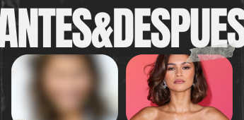 ANTES-DESPUES
