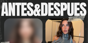 ANTES-DESPUES