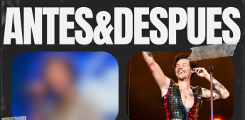 ANTES-&-DESPUES