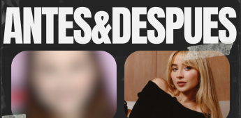 ANTES-&-DESPUES