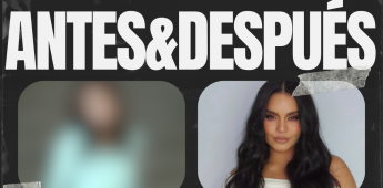 ANTES-&-DESPUÉS
