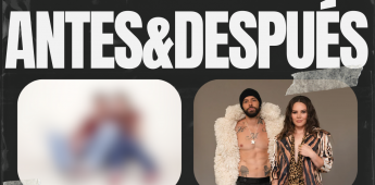ANTES-&-DESPUES