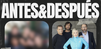 ANTES-&-DESPUÉS