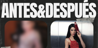 ANTES-&-DESPUES