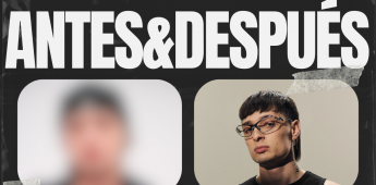 ANTES-&-DESPUES