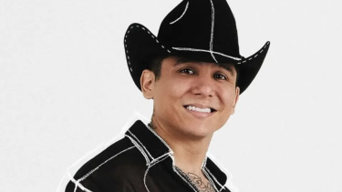 Edwin Luna sorprende con radical cambio tras realizarse procedimiento estético
