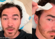 Kevin Jonas revela que fue operado por un cáncer de piel